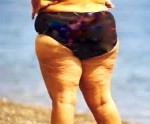 Cellulite Sucks!